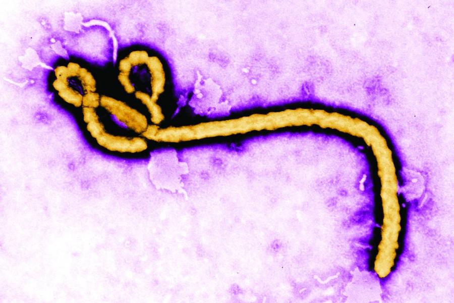 Some of the ultrastructural morphology displayed by an Ebola virus virion is revealed in this undated handout colorized transmission electron micrograph